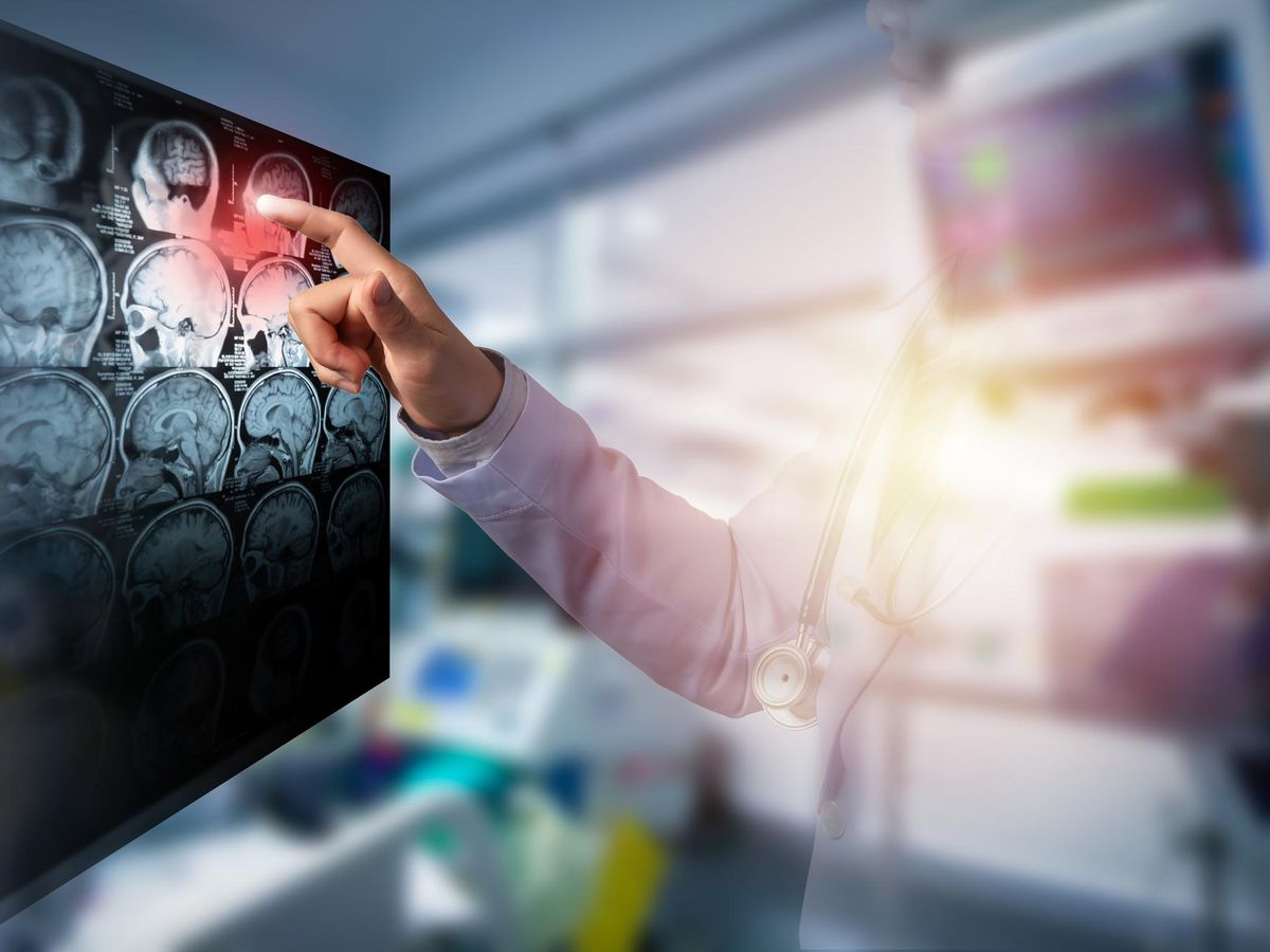 Diagnostyka obrazowa w neurologii – co powinieneś wiedzieć o nowoczesnych metodach neuroobrazowania